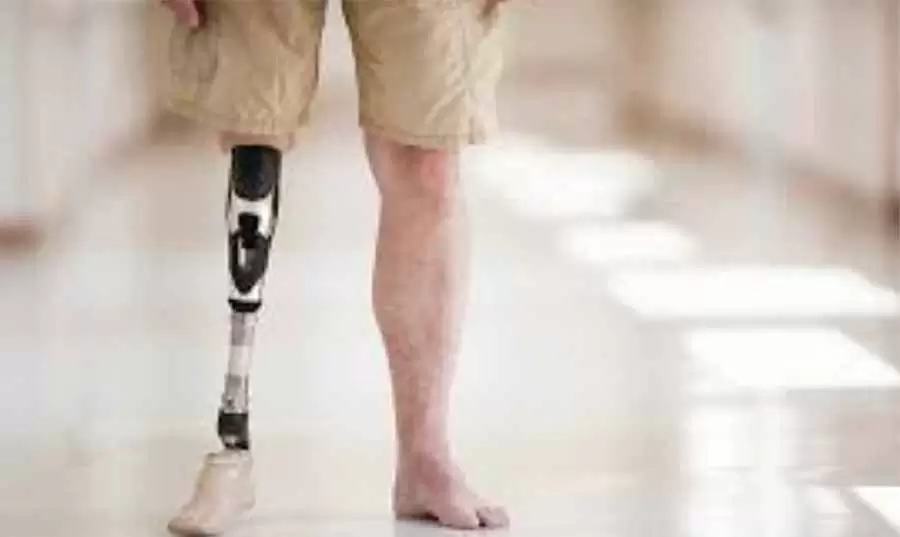 علماء يكتشفون آلية لاستعادة الأطراف المفقودة بالكامل