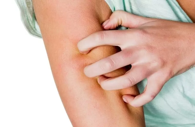 احذر الحكة بعد الاستحمام.. قد تكون أكثر من مجرد جفاف في الجلد!