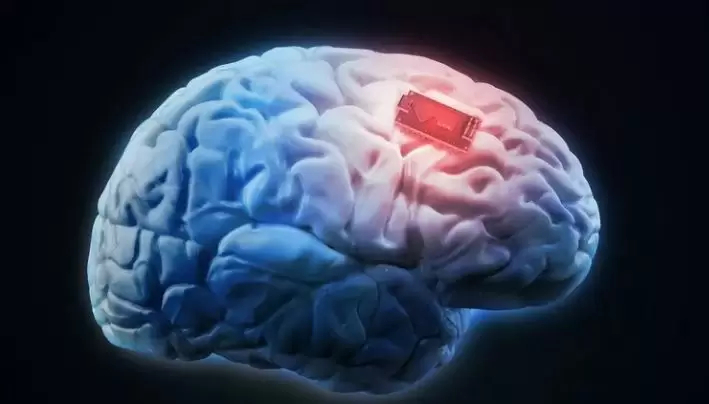 علماء يطورون شريحة دماغية لترجمة الأفكار إلى كلمات