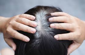 حل يثير جدلا طبيا.. حقنة قادرة على إخفاء الشيب من رأسك