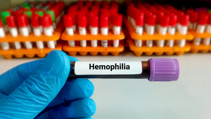 7 فحوص للدم يحتاجها كل شخص فوق سن الأربعين