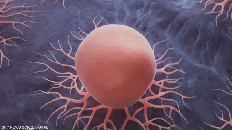 اختبار دم ثوري يكشف السرطان قبل 10 سنوات من ظهوره