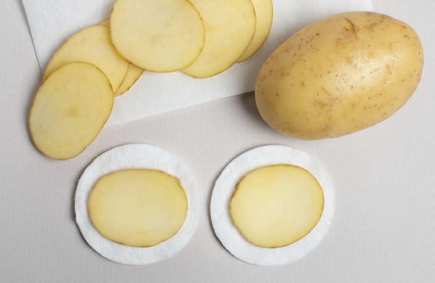 البطاطا.. “كنز حقيقي” للعناية بالبشرة