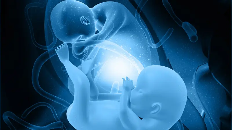 حالة نادرة.. مصرية حامل بـ9 أجنة