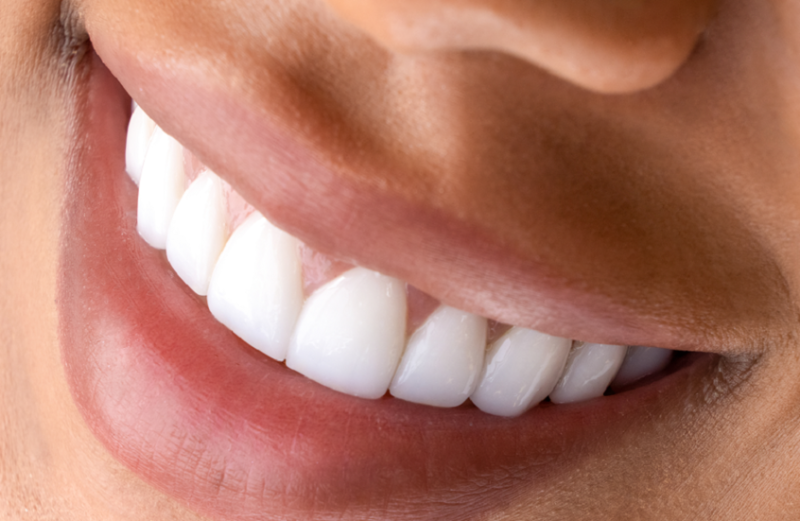 نصائح ذهبية لأسنان بيضاء مثالية