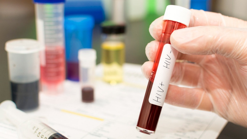 415 إصابة جديدة بالسيدا في تونس سنة 2024