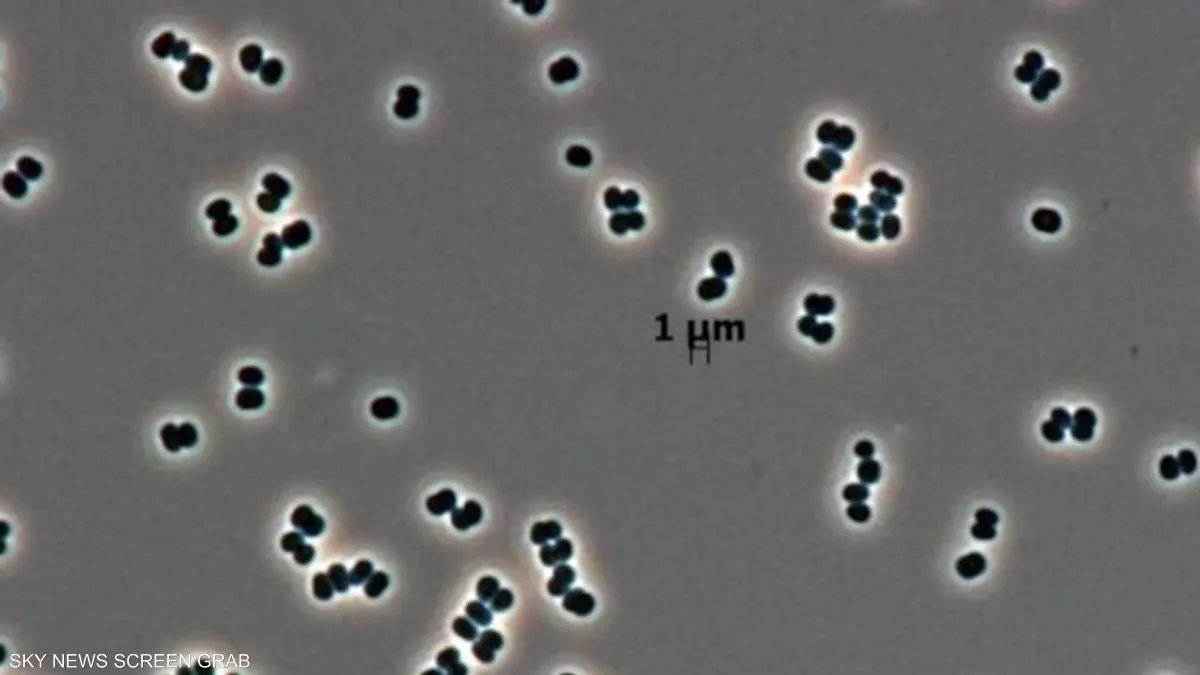 حتى في بيئة معقمة.. اكتشاف بكتيريا قادرة على التظاهر بالموت