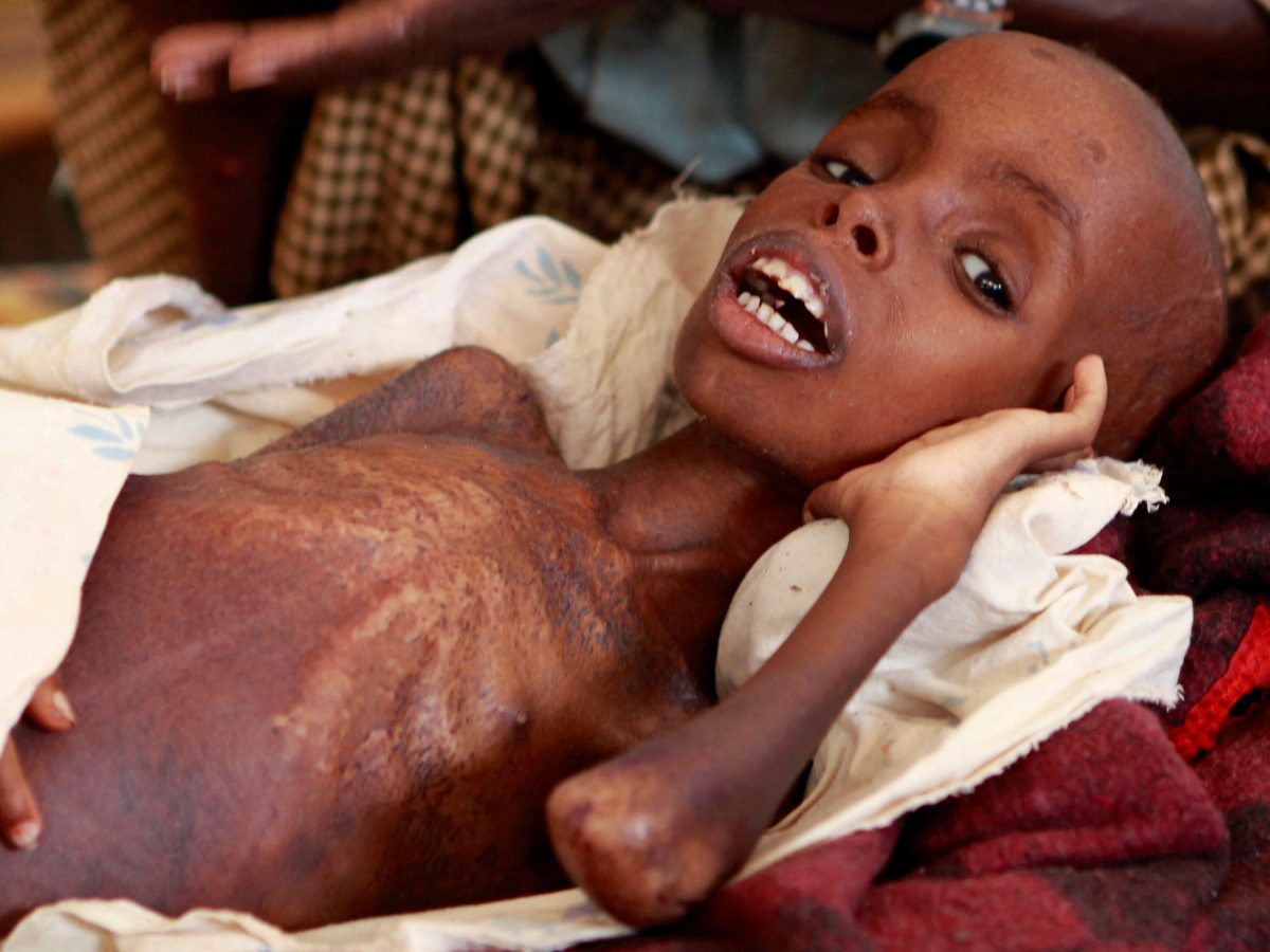 تحذير أممي من أسوأ أزمة جوع تضرب الصومال