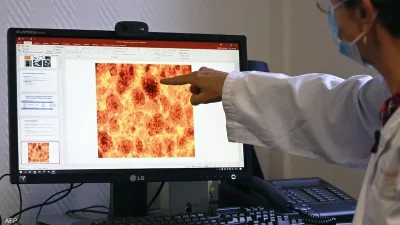 article-thumb