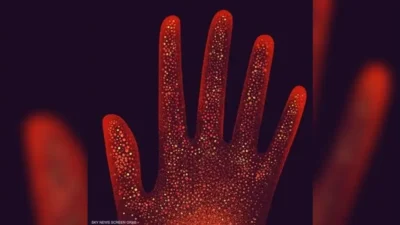 article-thumb