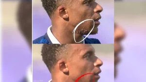 article-thumb