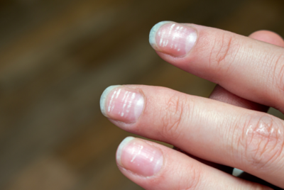 article-thumb
